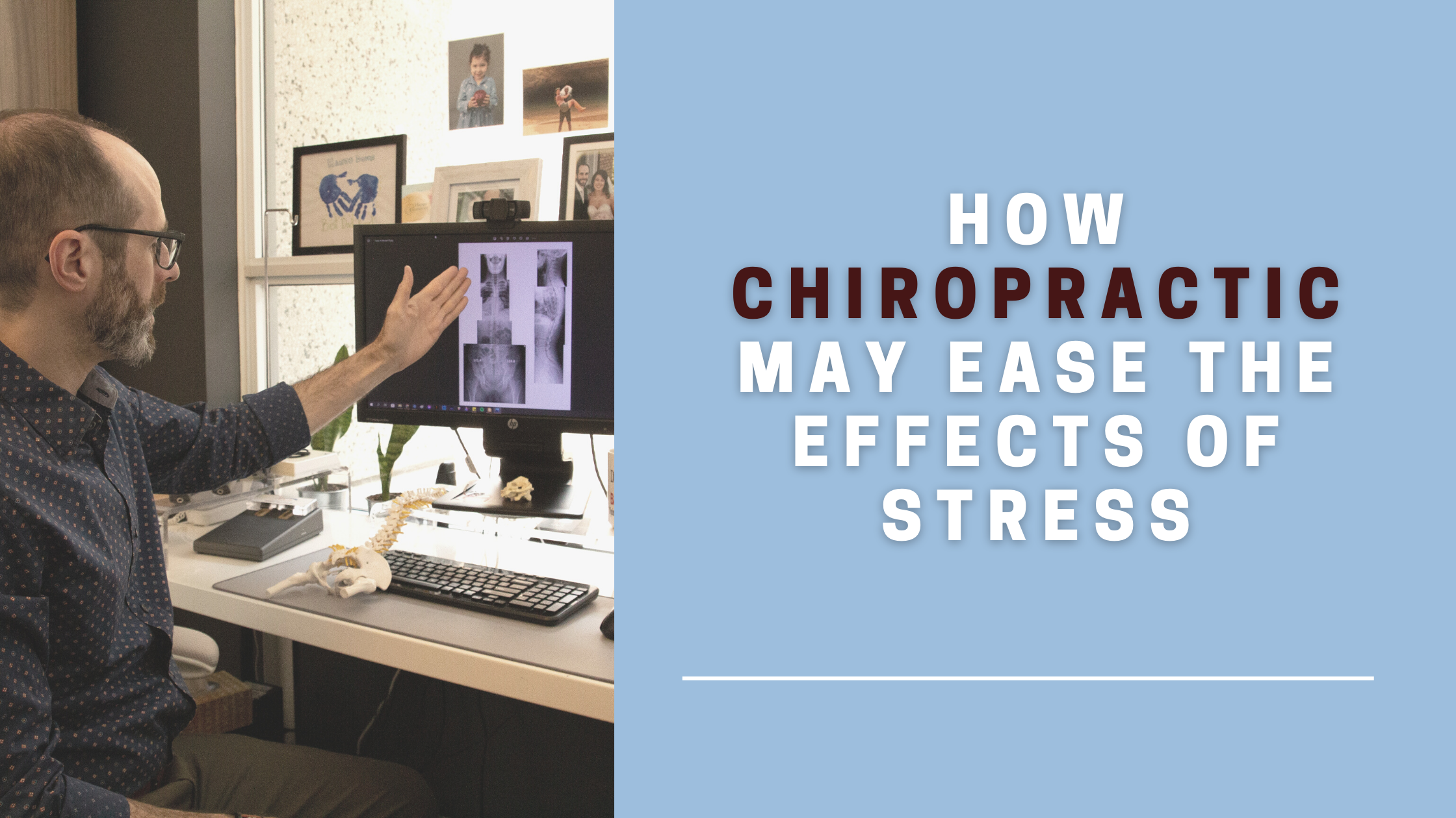 toronto chiropractor dr. joshua gelber pointing to an x-ray on a screen words How Chiropractic May Ease the Effects of Stress